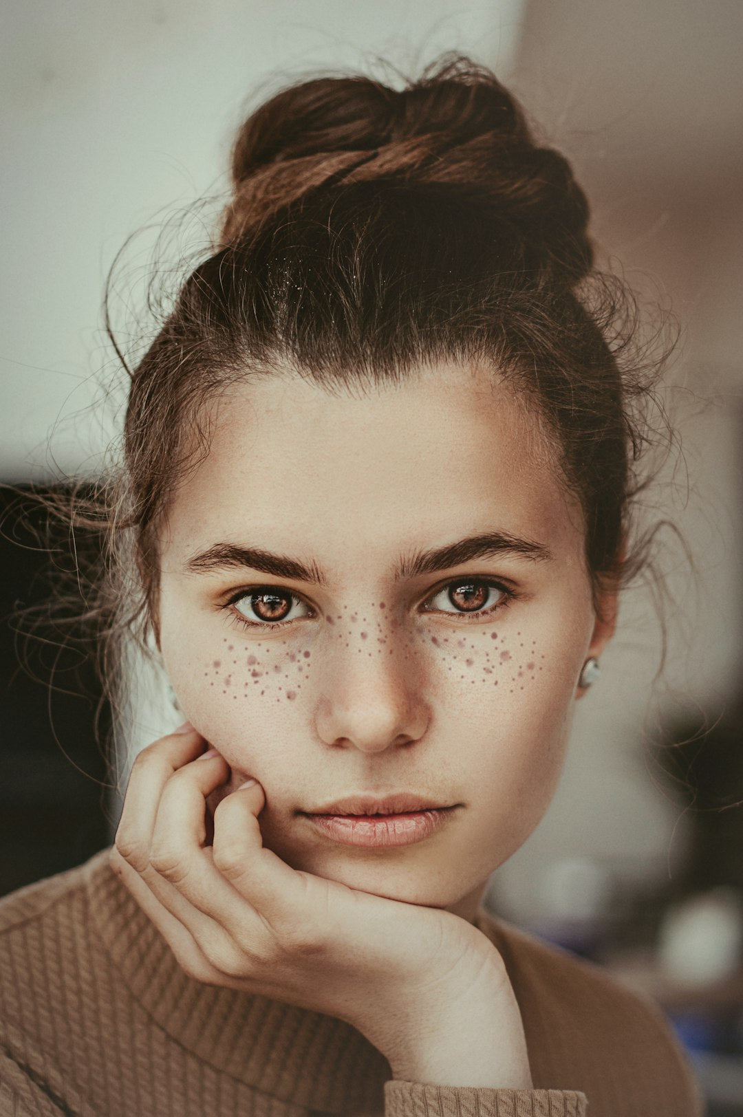 The Science Behind Acne: Skincare Solutions
